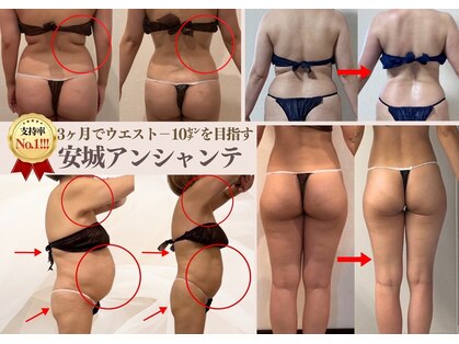 アンシャンテ(Enchante)の写真