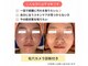 ベベ もりの里店(Be'be')の写真