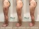 ハネ 自由が丘(Hane)の写真/【自由ヶ丘初・術後特化店】浮腫み/硬さ/動かしづらさを改善！プロの知識×術後経験者が完全カスタマイズ◎