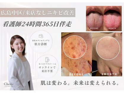 シェリー(Cherie)の写真