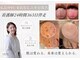 シェリー(Cherie)の写真