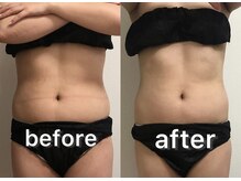 ベルフィーヌ 北千住店(BELFINE)/充実コースビフォーアフター