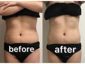 ベルフィーヌ 北千住店(BELFINE)/充実コースビフォーアフター