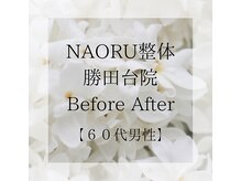 ナオル整体 勝田台院(NAORU整体)/施術事例【60代男性】首の痛み
