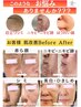 【6月限定】光フェイシャル 5回セット¥25,500