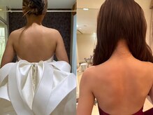 カレンジェビューティー(CarengeBeauty)/ブライダルエステ/痩身