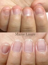 マリーロール 淀屋橋本店(Marie Laure)/自爪育成/深爪矯正/ネイルケア