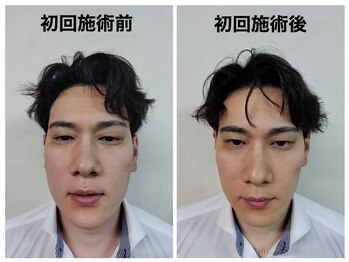 トータルバランス整体院 &nbsp;オレンジ(ORANGE)/小顔矯正/整体/肩こり/梅田/小顔