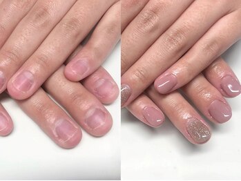 リネイル 川越(Re:NAIL)の写真/爪のコンプレックスにサヨナラ！長さ出しで指先から自信を。