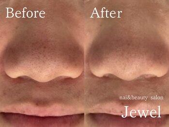 ジュエル(Jewel)/マグマハーブ一回の効果