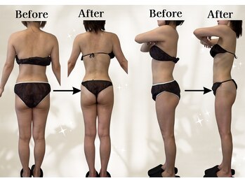 リリーシャ 赤坂(LILISHA)/骨ストのお腹ぺたんこ!肋骨薄く