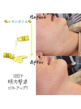 ルミナエステ(LUMINA ESTH)/脂肪分解剤レモンボトル 