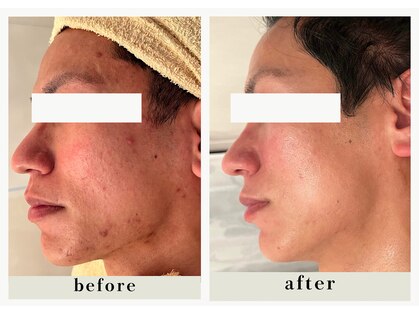 ミウ(MIU)の写真