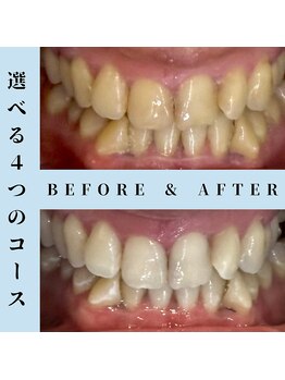 ドルチェ 水戸店(Dolce)/★ before → after ★