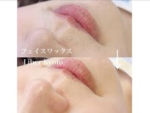 エステティック リベル キョウト 京都駅前店(Esthetic Liber Kyoto)/フェイスワックス脱毛