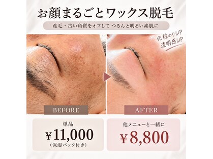 キノン(kinon)の写真