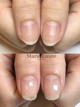マリーロール 梅田店(Marie Laure)/自爪育成/深爪矯正/ネイルケア