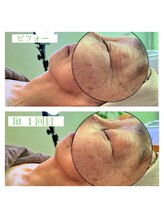 アンレーブ(an'reve)/【エアジェット１回目】