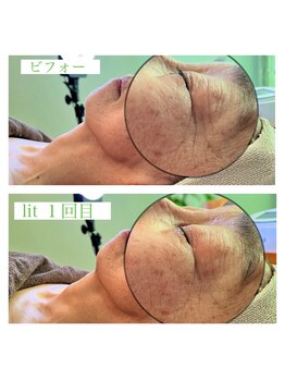 アンレーブ(an'reve)/【エアジェット１回目】