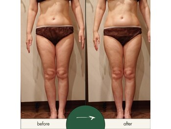 リラムーン(Relamoon)/バザルトボディ90分1回で♪♪