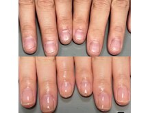 リヒネイル(Rihi.nail)の雰囲気(深爪から美爪に!)