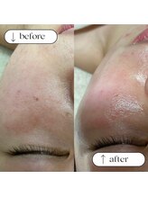 トータルビューティーサロンリア(Li'a)/ビフォー＆アフター