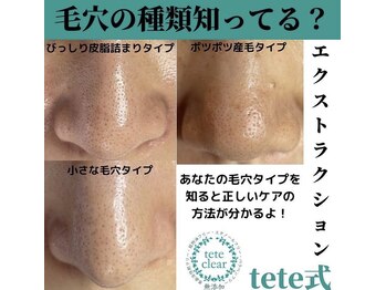 毛穴屋/毛穴洗浄毛穴エクストラクション