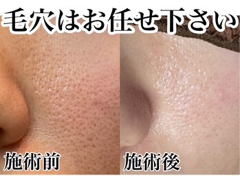 アンドピエル(AndPiel)/肌悩みはお任せください。