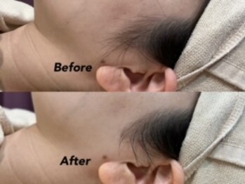 クイーン(QUEEN)/成人式前はシェービング！