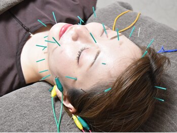 ドリームメディカルスタイル(Dream Medical Style)の写真/女性鍼灸師ならでは★独自MENU美容鍼×ヒト臍帯血幹細胞レアリゼフェイシャルで小顔/美肌/エイジングケア♪