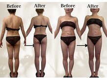 リリーシャ 赤坂(LILISHA)/お腹の弛み激減!パンツ3インチ減