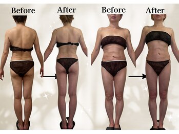 リリーシャ 赤坂(LILISHA)/お腹の弛み激減!パンツ3インチ減