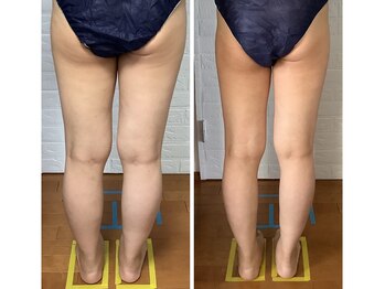 ビューティフルムーン(Beautiful Moon)/一撃コース 3時間後この細さに♪