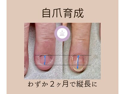 ネイルサロン ココマリー(coco marry)の写真