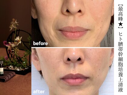 ラジェ 静岡駅南店(LAGE)の写真