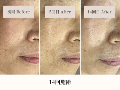 イト(ito)の写真