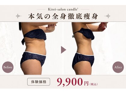 キャンドル(candle')の写真