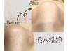 毛穴もむくみもスッキリ[超音波＆吸引]徹底毛穴洗浄×小顔フェイシャル90分　