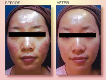 ジュリア オージェ 京橋店/ビフォーアフター(フォトFa)