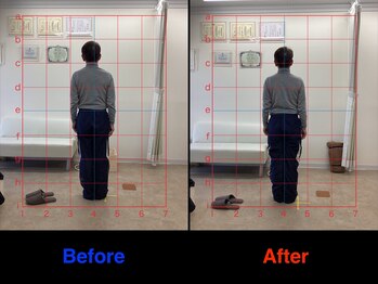 仁 久喜院(JIN)/#手根管#関節#うでの痛み