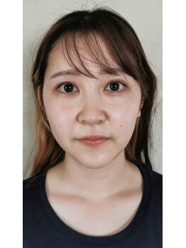 美姿勢☆倶楽部　ずくだし屋/リフトアップ↑な小顔♪