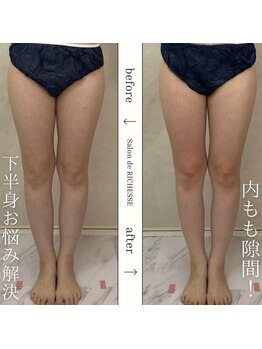 サロンドリシェス(Salon de RICHESSE)/内ももに隙間！下半身お悩み改善