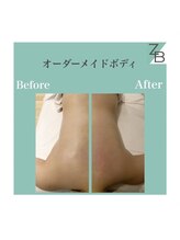 ザラハビューティー(ZARAHA Beauty)/オーダーメイドボディ