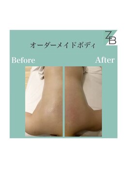 ザラハビューティー(ZARAHA Beauty)/オーダーメイドボディ