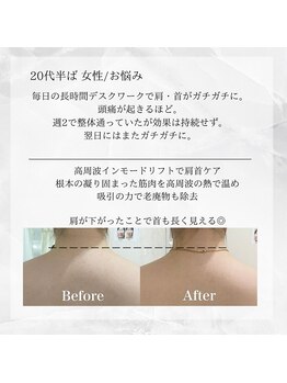 メディカルエステ 東銀座店/20代半ば 女性