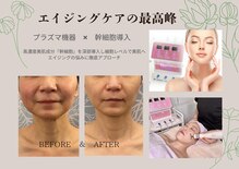グロッシー(glossy)