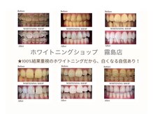 ホワイトニングショップ 霧島店の雰囲気（効果を実感！症例写真を公開中！通うたびに白さアップを実感。）
