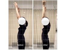 エモアメディカル整体院 麻布十番(Emoaメディカル整体院)/【20代女性】慢性的な肩こり