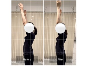 エモアメディカル整体院 麻布十番(Emoaメディカル整体院)/【20代女性】慢性的な肩こり