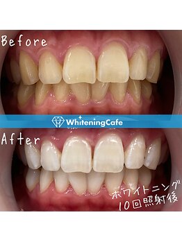 ホワイトニングカフェ イオン新潟青山店(WhiteningCafe)/